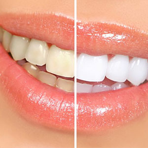 Achieve Your Dream Smile with a Cosmetic Dentist in Miami Gardens